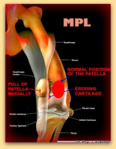 Medial patella luxation in bulldogs and French bulldogs