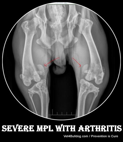 Bulldog hip dysplasia with MPL severe
