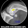 4th degree MPL patella luxation bulldog