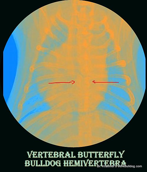 bulldog vertebral malformation hemivertebrae butterfly