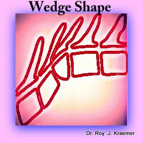 Wedge shape kypohsis Spinal Vertebral Abnormalities in Bulldogs Butterfly