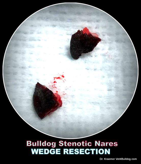 Stenotic Pinched Narrow Nares in English Bulldogs wedge resection