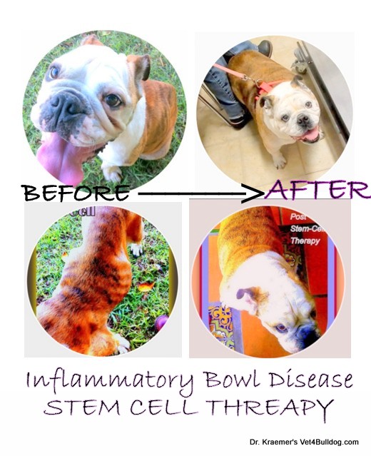 Piper IBD before and after stem cell therapy