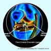 ACL injury in bulldogs
