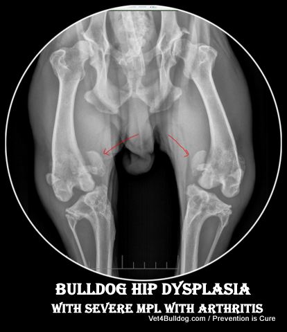 bulldog hip dysplasia with severe arthritic MPL