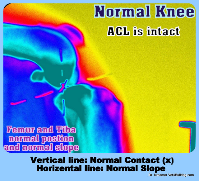 ACL rapture Bulldogs French Bulldogs NORMAL KNEE