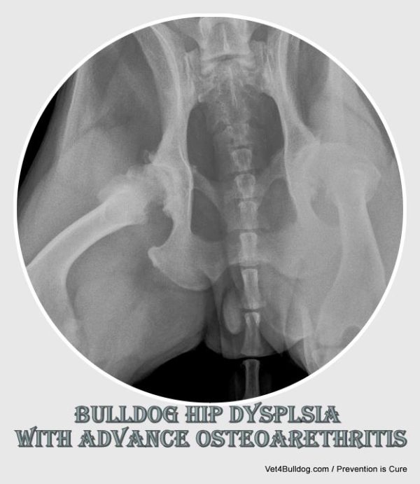 X-ray shows bulldog hip dysplasia with advanced osteoarthritis.