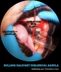 bulldog salivary mucocele ranula