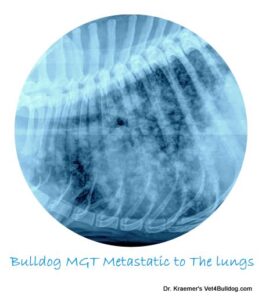 MGT metastatic disease to the lungs