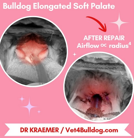 elongated soft palate before and after surgery
