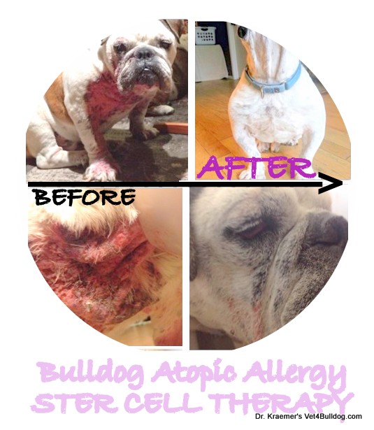 Atopic Allergy Stem Cell fore and after