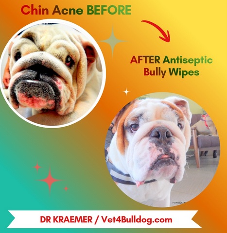 bulldog acne before and after antiseptic wipes