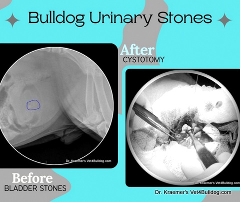 Bulldog cystotomy before and after