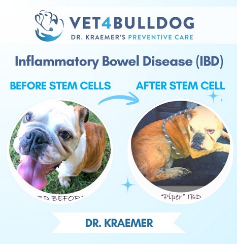 Treating IBD with stem cells