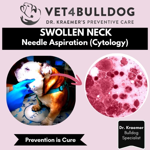 Swollen Neck Cytology