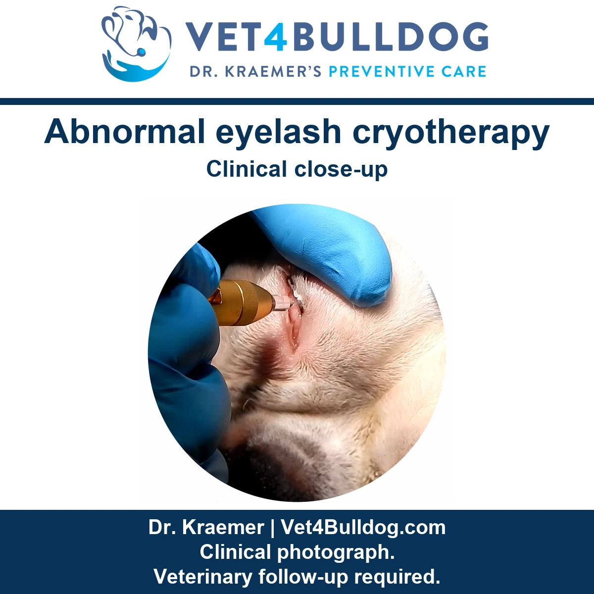 Original Bulldog eyelid photograph showing blue-gloved hands and a gold cryotherapy instrument