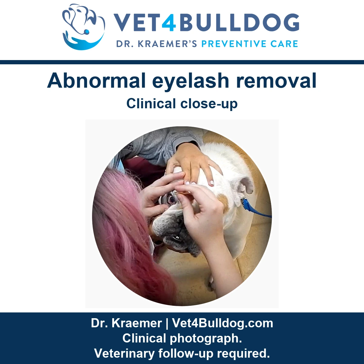 Original Bulldog clinical photograph showing a clinician examining and removing an abnormal eyelash