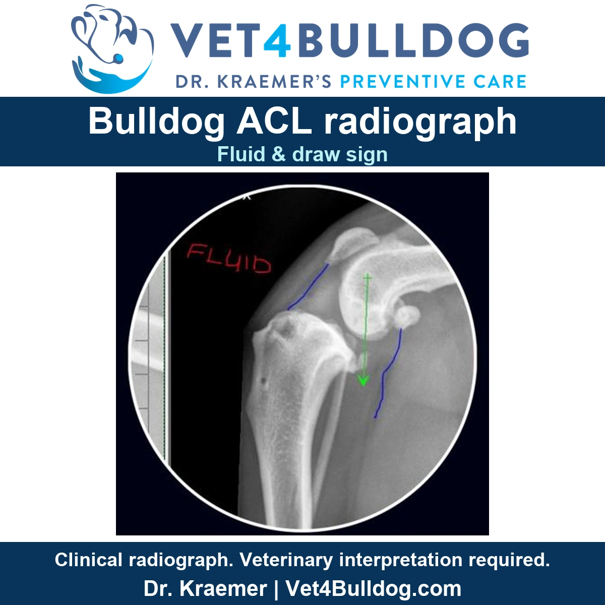 Original Bulldog knee radiograph with preserved red Fluid annotation, blue outlines and green arrow.