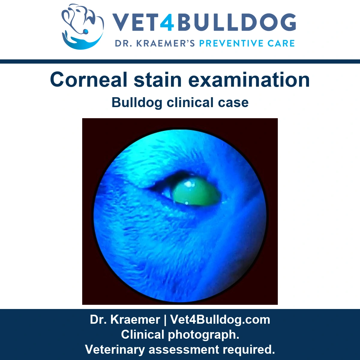 Bulldog corneal stain examination revealing an ulcer invisible to the naked eye