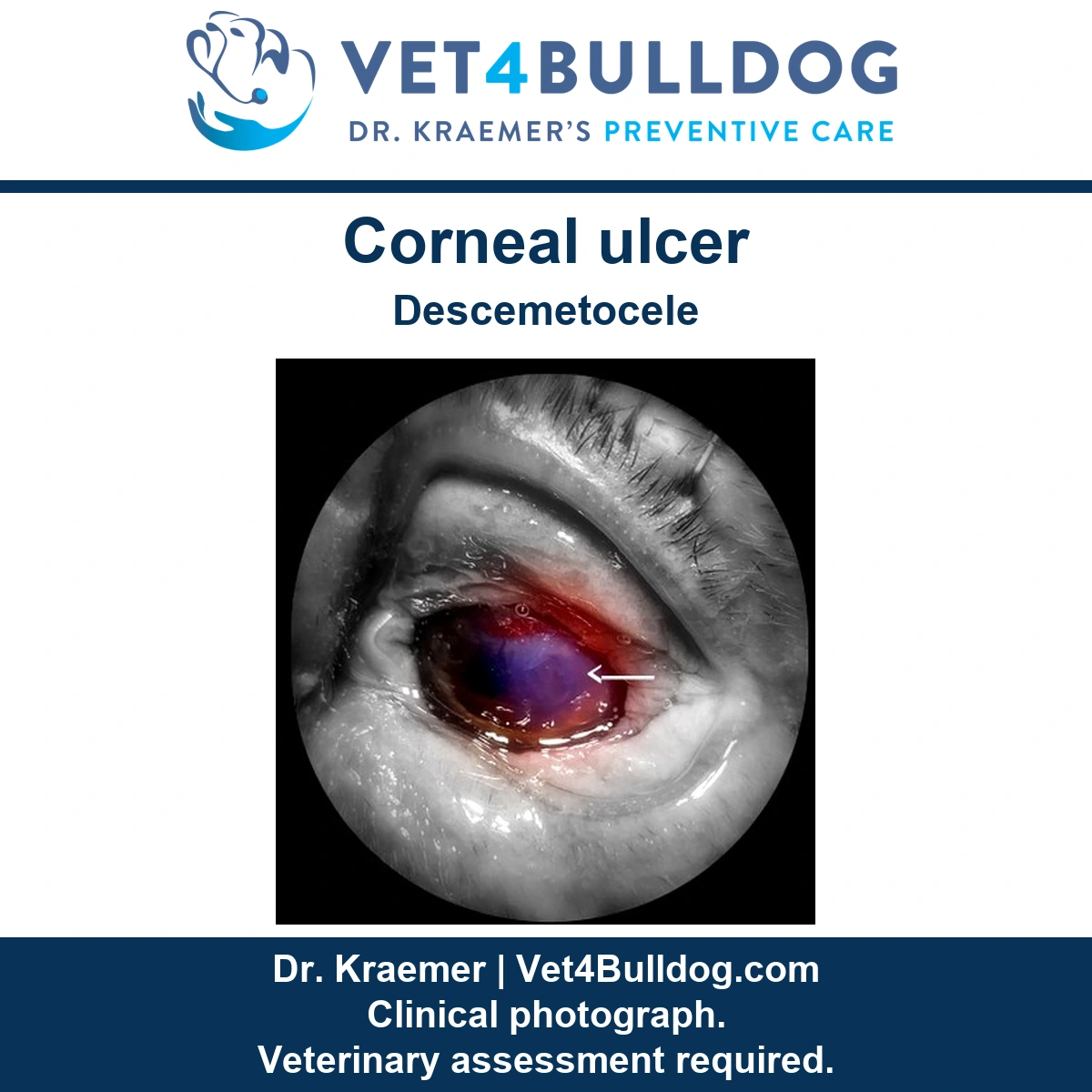 Original clinical eye close-up showing the cornea, eyelid and preserved white arrow