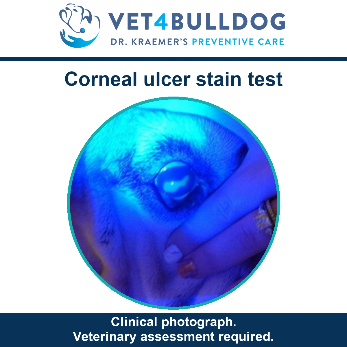 Bulldog eye examined under blue light during corneal ulcer staining.