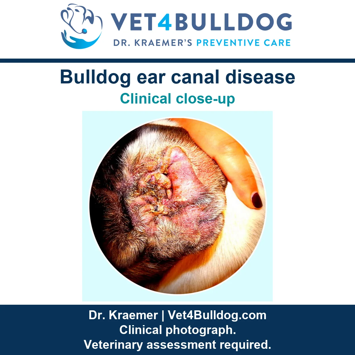 Original Bulldog ear close-up showing thickened, reddened canal tissue held open by a red-nailed hand.