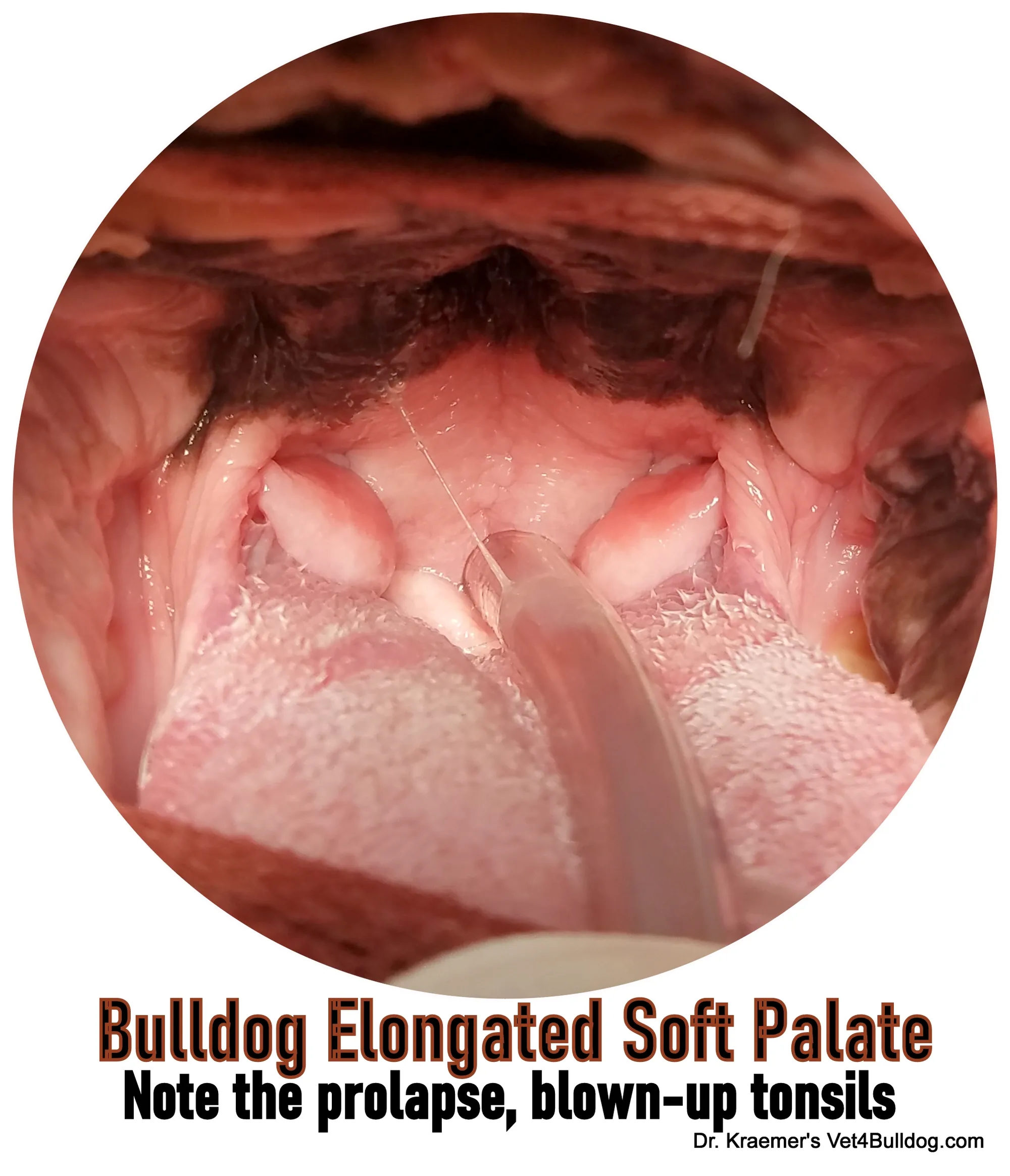 Intraoral photograph showing a Bulldog’s soft palate and prominent tonsils beside an airway tube, with the original Dr. Kraemer caption.