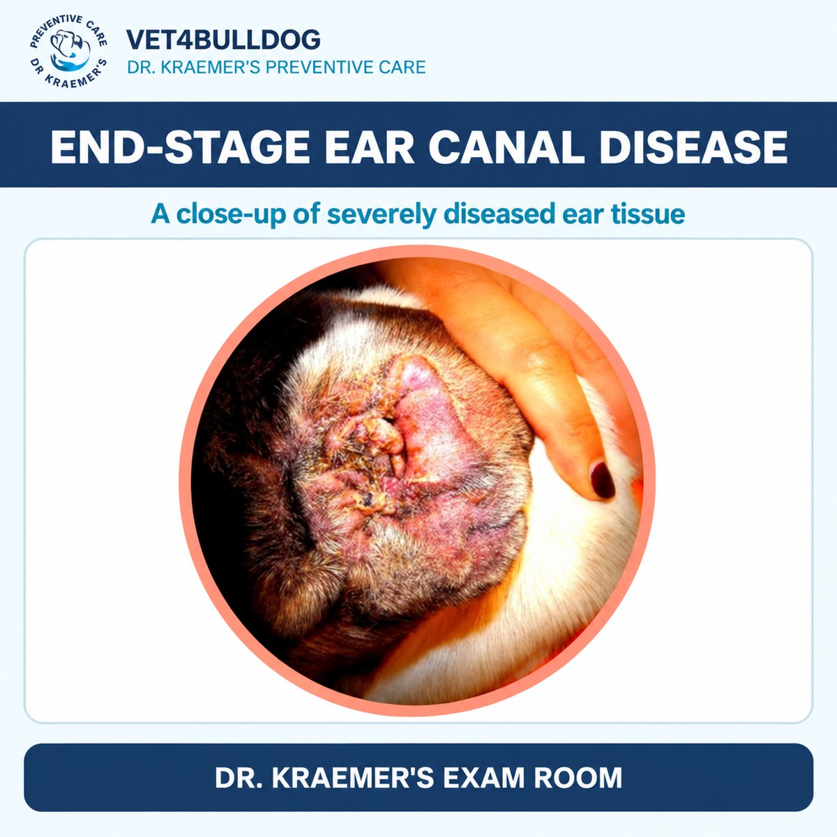 Bulldog End-Stage Ear Canal Disease - Dr. Kraemer Exam Room Close-up of a Bulldog ear with severely thickened diseased tissue and discharge.