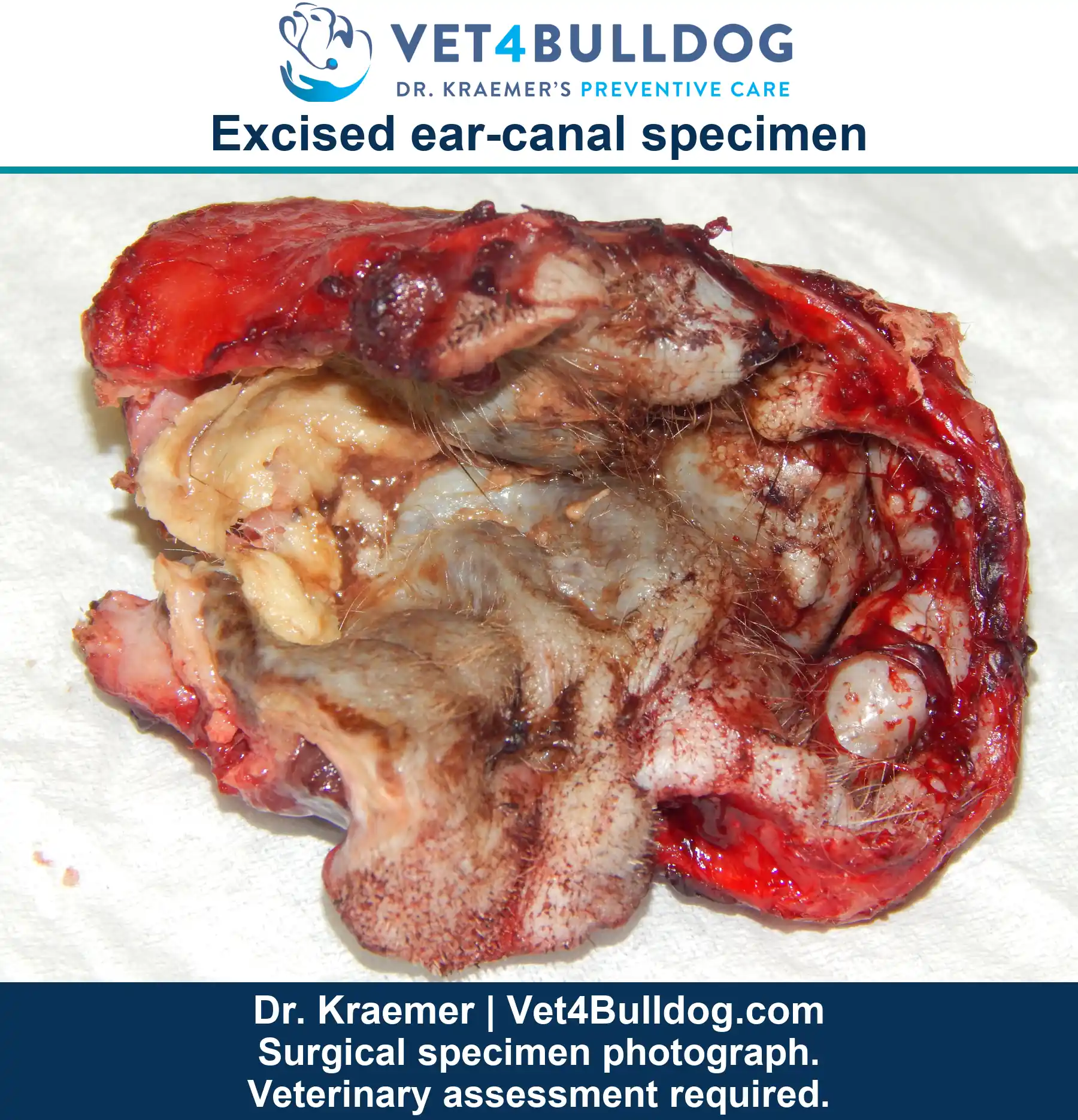 Opened excised Bulldog ear-canal specimen resting on white gauze in the original surgical photograph.
