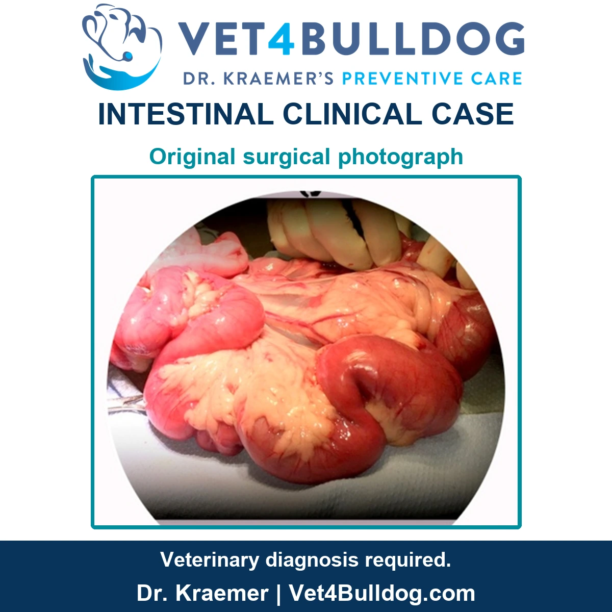 Original surgical photograph of exposed intestinal loops with a gloved hand in the supplied Bulldog intestinal case.