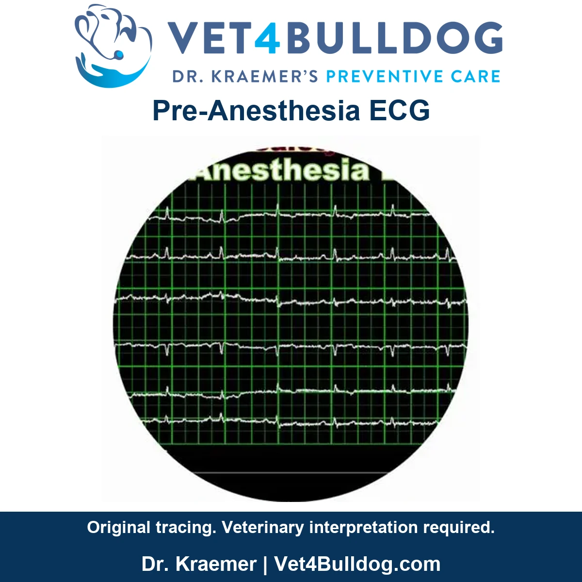 Original six-trace pre-anesthesia ECG screen preserved without changes to waveforms or recorded values.