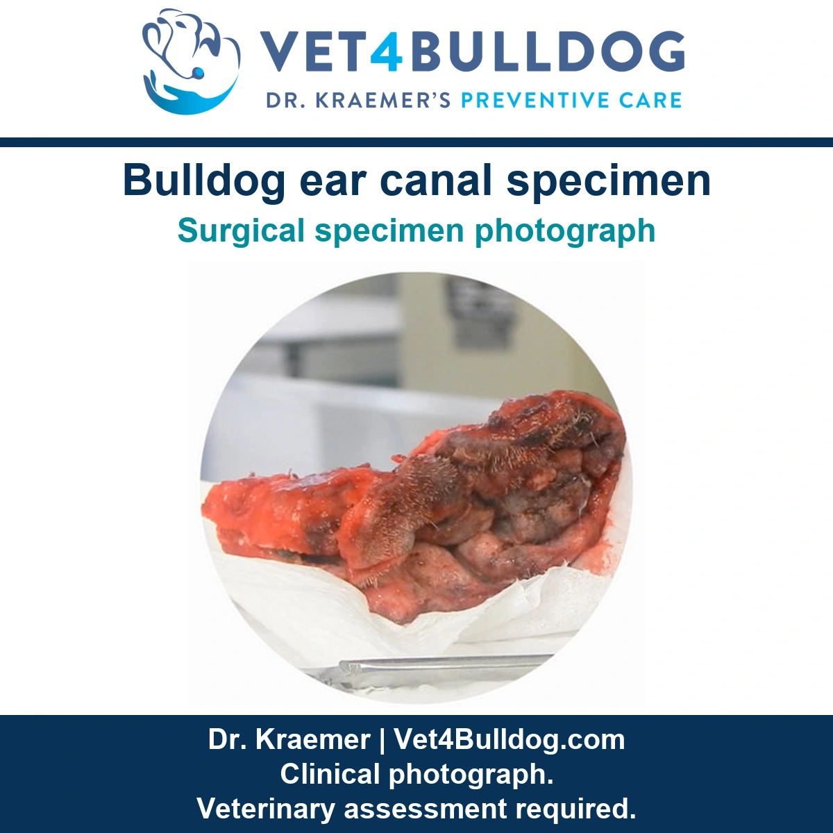 Original surgical specimen photograph showing a resected diseased Bulldog ear canal.
