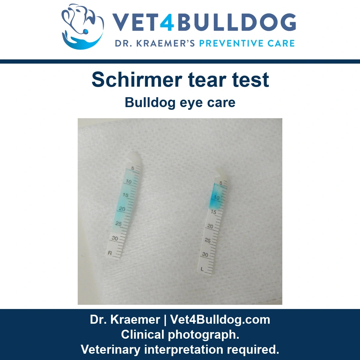 Two original Schirmer tear-test strips marked R and L, showing blue dye levels and measurement scales.
