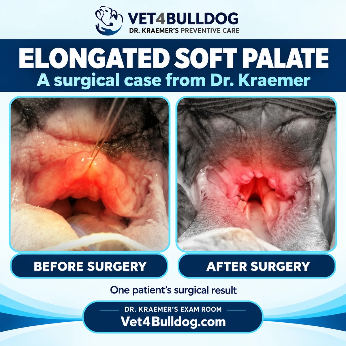 One patient’s elongated soft palate before and after surgery in Dr. Kraemer’s clinical case
